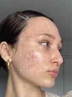 Oil Control Facewash - Tea Tree Oil with Salicylic Acid 2%