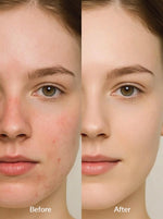 Advanced Barrier Repair Moisturizer - Ceramides 1% + Niacinamide 6% + HA 1% + B5 1%