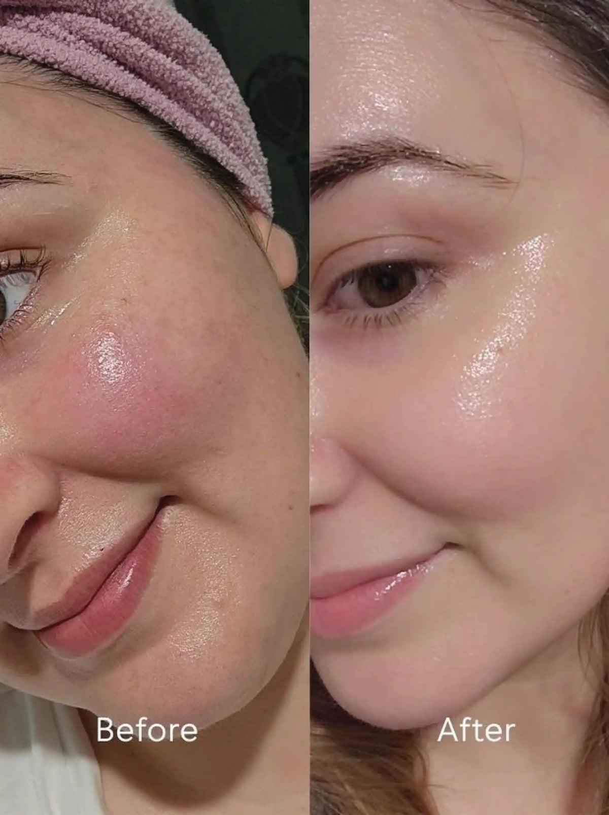 Daily Brightening Moisturizer - Kojic Acid 3% + Alpha Arbutin 2% + Niacinamide 6% + Hyaluronic Acid 1%