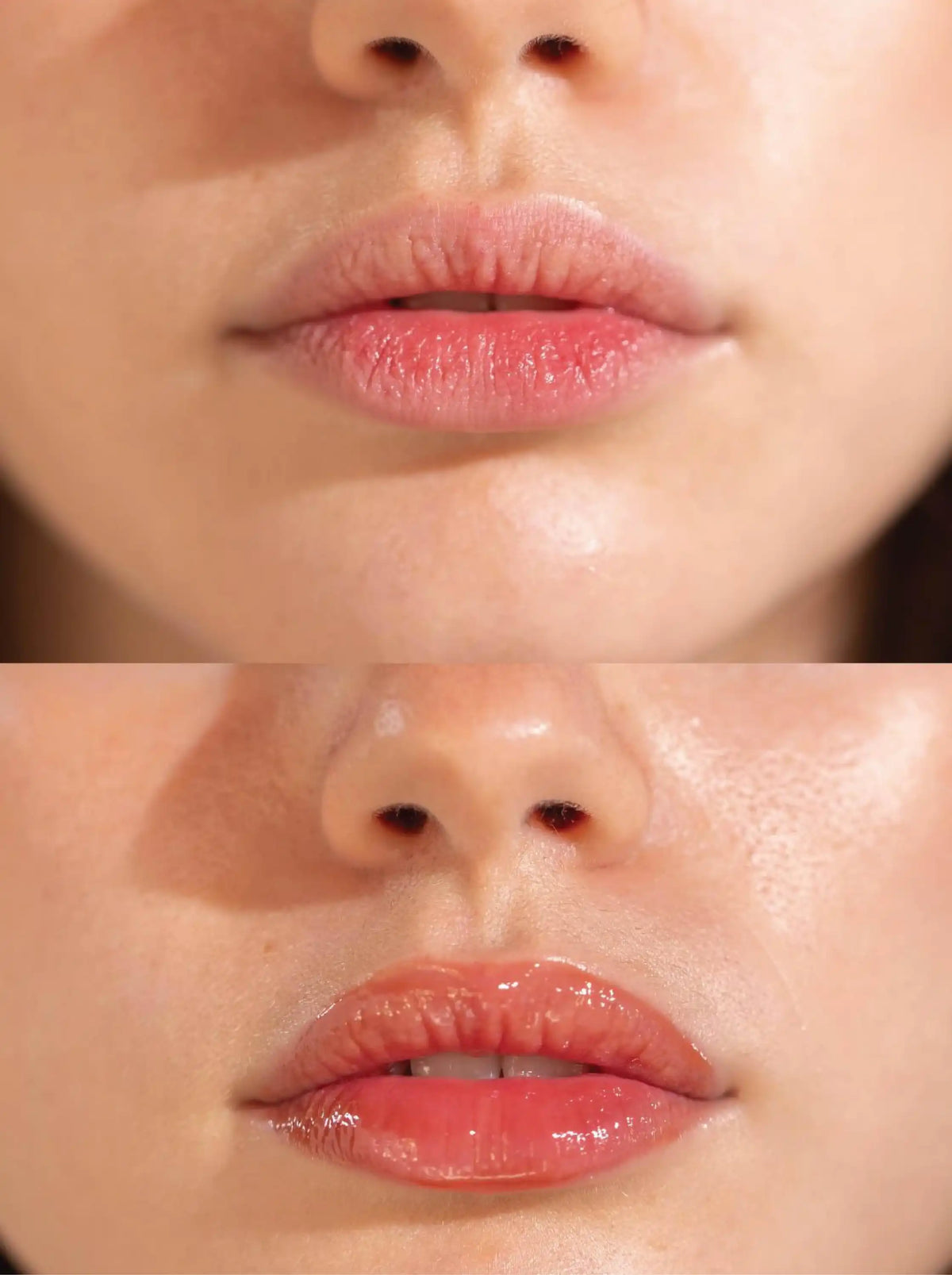 Lip Balm with Shea Butter + Kojic Acid