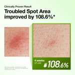 Azelaic Acid 10 Hyaluron Redness Soothing Serum - Anua