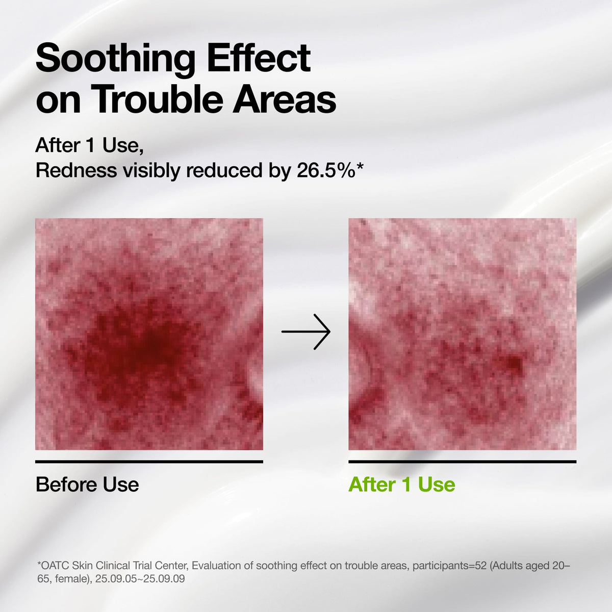 Azelaic Acid CICA Skin Soothing Moisturizer - Anua