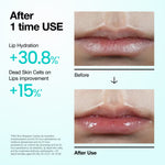 PDRN Lip Serum - Anua